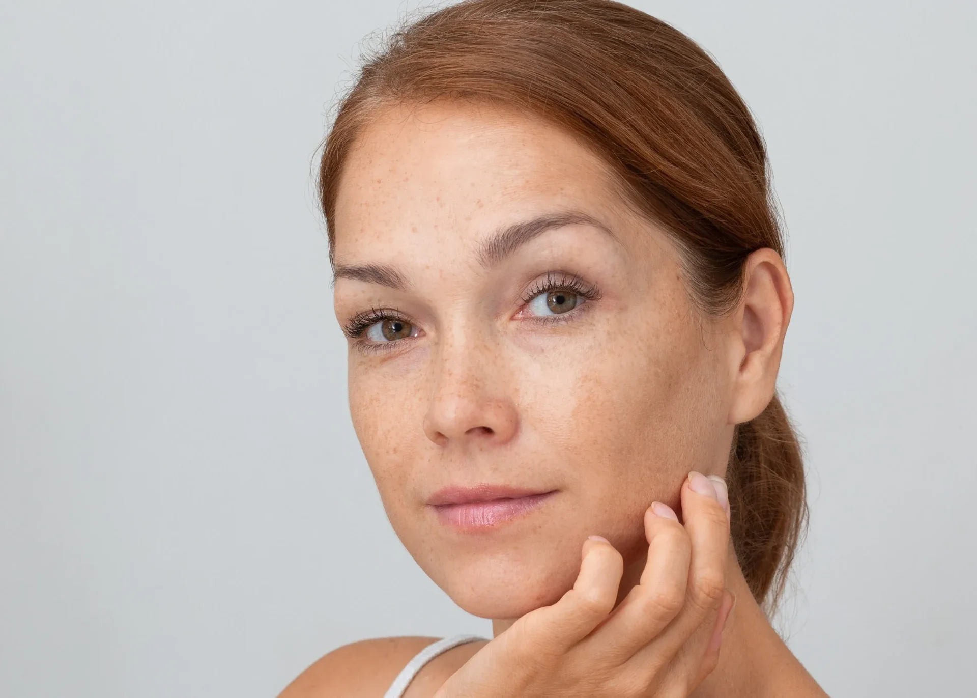 Woman with freckles touching her cheek.